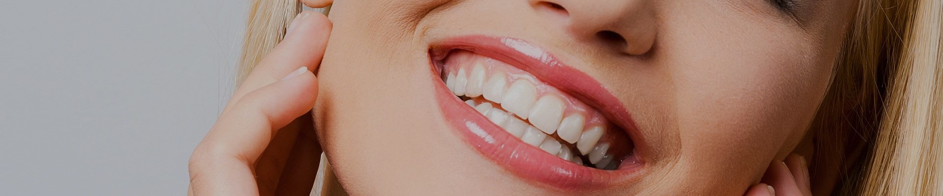 imagem de clareamento dental